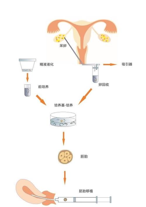 取卵后多长时间能移植，全面解析试管婴儿过程中的关键因素