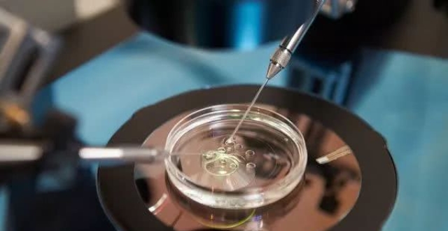 微刺激方案下的取卵过程解析，几趟之旅